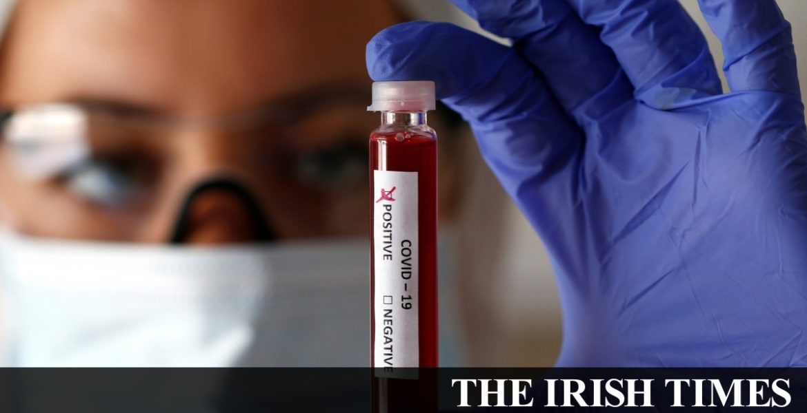 Waiting for a coronavirus test in Dublin: ‘My chest is raw. My lungs ache’