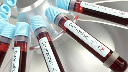 Analysis: Testing failings mean we do not know exactly where the virus is circulating